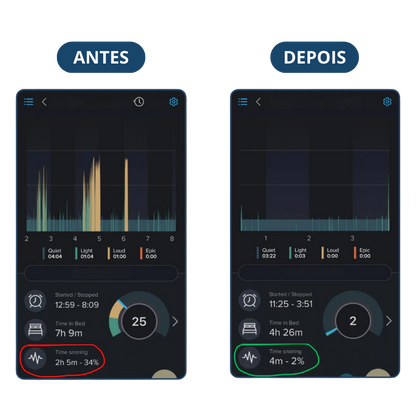 Protetor Bucal Anti-Ronco Znorex®